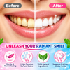 MySmile Niacinamide Toothpaste 100g ( Pack of 2 )