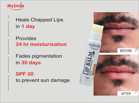 MySmile Lip Balm with SPF 30 | Hydrating & Sun Protection for Soft Lips