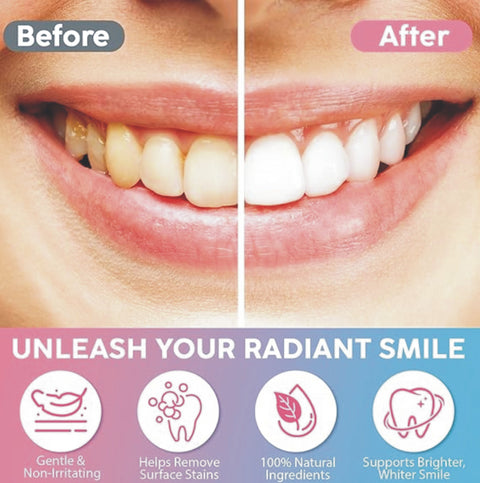 MySmile Niacinamide Toothpaste 100g